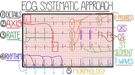 ecg for dummies|Basic ECG interpretation made simple .